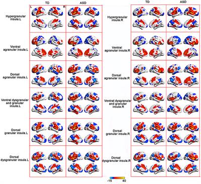 Both Hypo-Connectivity and Hyper-Connectivity of the Insular Subregions Associated With Severity in Children With Autism Spectrum Disorders